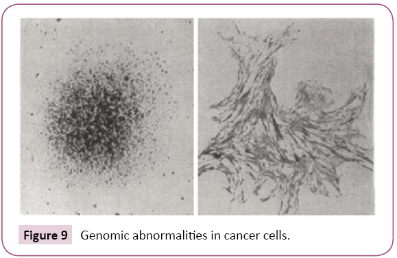 Archives-Cancer-Research-Genomic-abnormalities